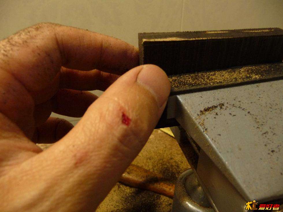 整形过程中，手受伤。