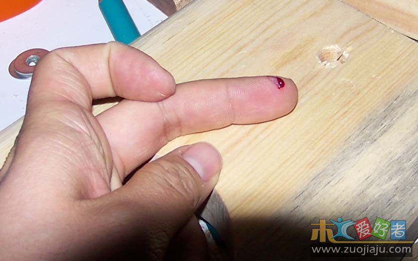 20090310被电钻伤了手指0733.JPG